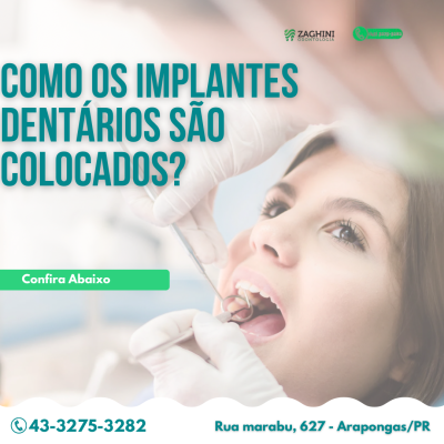 Zaghini Odontologia Implantes Dentários Ortodontia foto 1